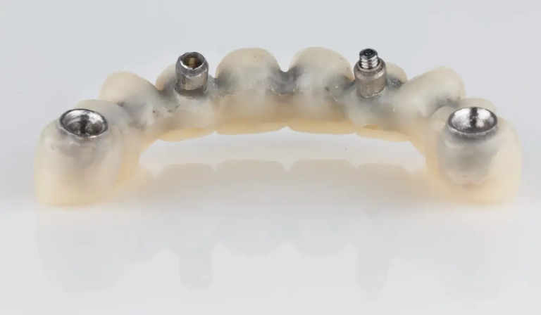 dental implants in Acton