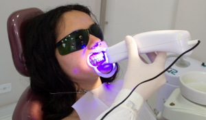 Cosmetic dentistry in Acton minimally invasive treatment at Dentistry On Sinclair