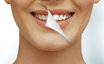 Teeth <span>Whitening</span>